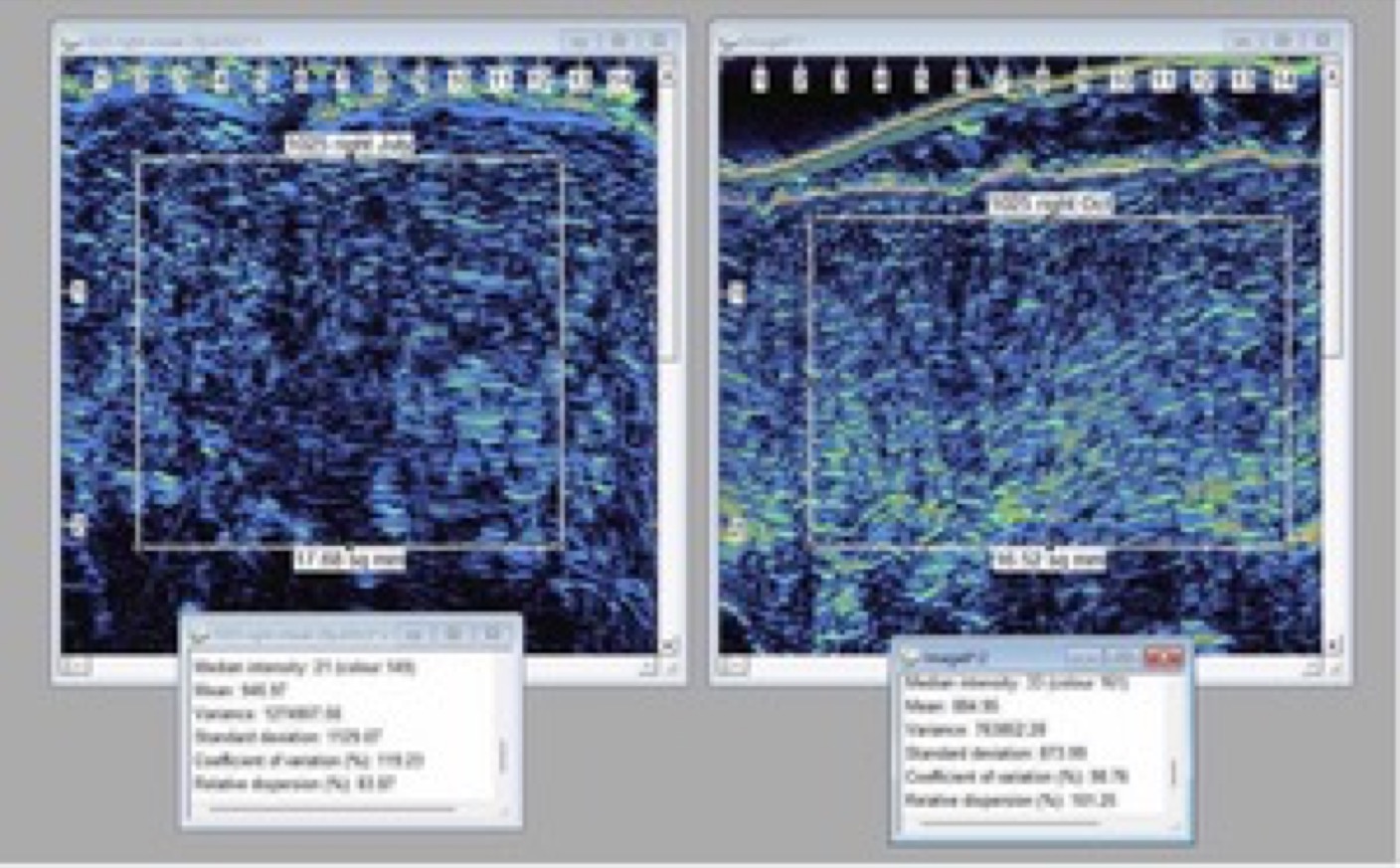 GHK-Cu Copper Peptide: 28% Average Collagen Increase in 21 Women Over 3 Months