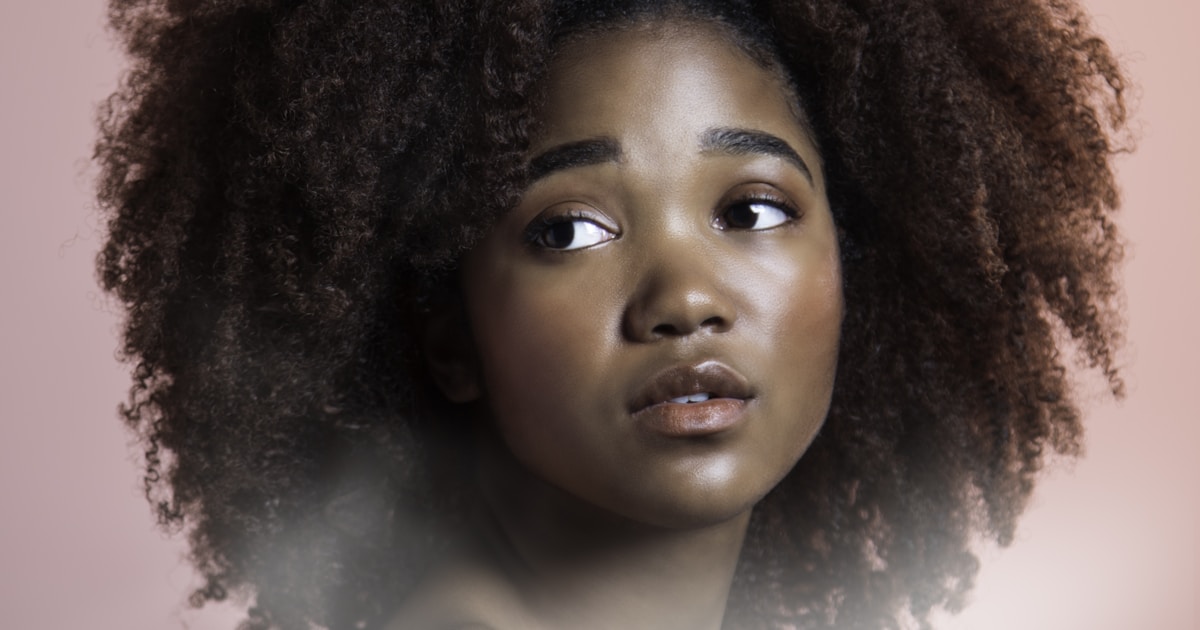 철분 결핍 탈모, 6개월 내 보충 시작하면 예후 개선